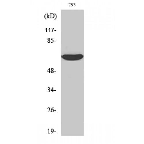 IRAK2 / IRAK-2 Antibody (Internal)