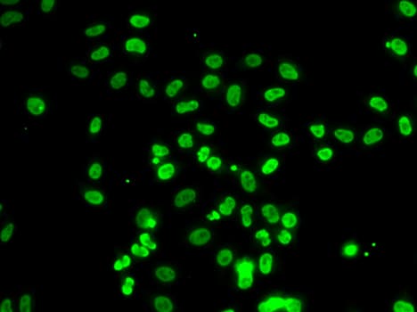 Polyclonal Rabbit anti-Human BAF53B / ACTL6B Antibody (IHC, IF, WB)
