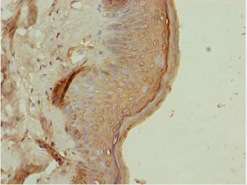 ATMIN Antibody
