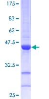 Human CDKN2D / p19 INK4d Protein (Recombinant GST)