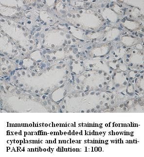 Polyclonal Rabbit anti-Human PAWR / PAR4 Antibody (IHC, WB)