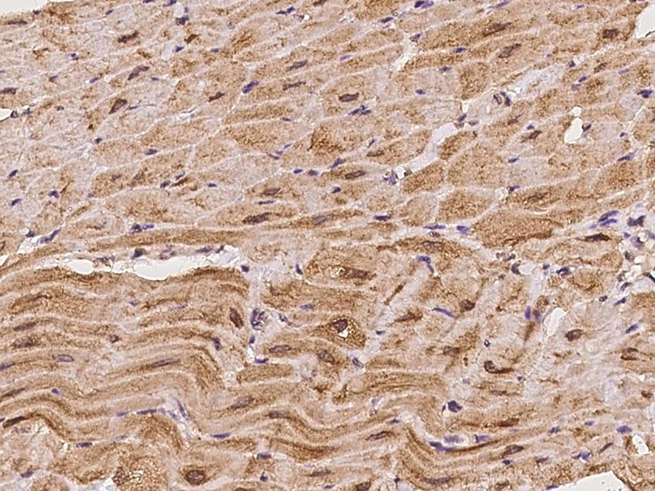 Polyclonal Rabbit anti-Human CAMK2D / CaMKII Delta Antibody (IHC)
