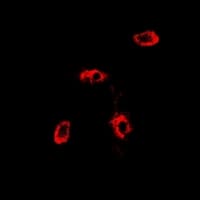 Polyclonal Rabbit anti-Human RAB11A Antibody (IF, WB)