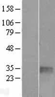 TGIF1 Protein (Over-Expression Lysate Myc-DDK (Flag))
