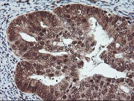 COPS5 / JAB1 Antibody (clone OTI2B12)