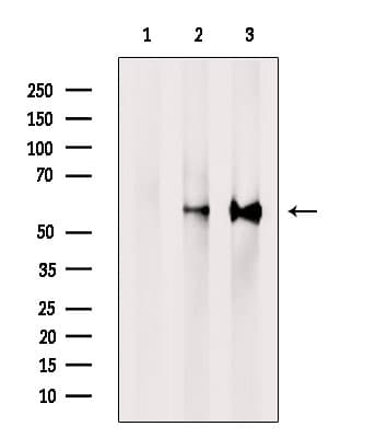 PPP3CB Antibody