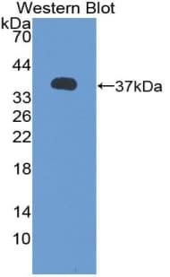 CALU / Calumenin Antibody (aa20-315)