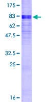 Human SLC16A1 / MCT1 Protein (Recombinant GST)