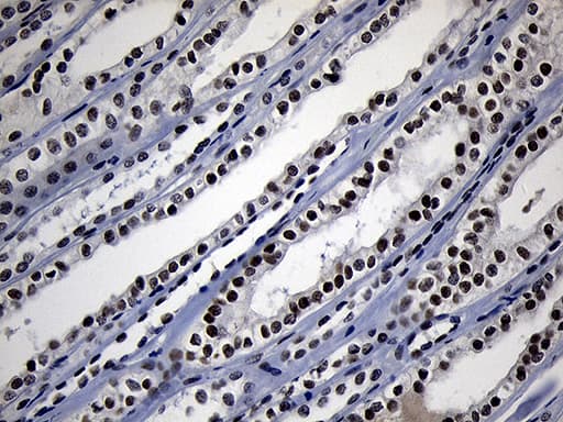 Monoclonal Mouse anti-Human ZHX2 / RAF Antibody (clone OTI2E11, aa595-837, IHC, WB)