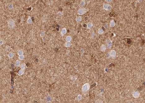 Polyclonal Rabbit anti-Human VEGFD Antibody (IHC, WB)