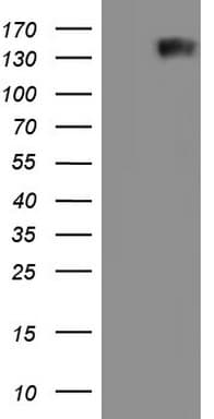 GLI / GLI1 Antibody (aa755-1106, clone OTI1C1)