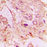 NDUFA6 Antibody