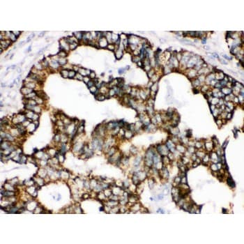TRAP1 / HSP75 Antibody (aa571-704)