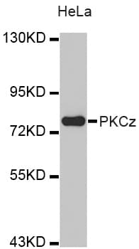Polyclonal Rabbit anti-Human PRKCZ / PKC-Zeta Antibody (IHC, WB)