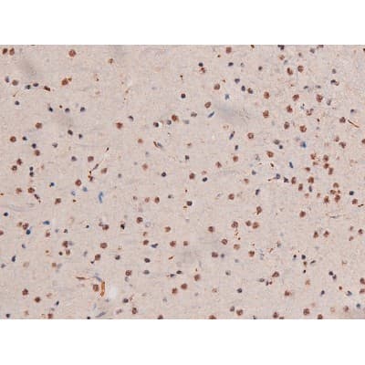 STAT3 Antibody (phospho-Ser727)