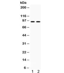 CALD1 / Caldesmon Antibody
