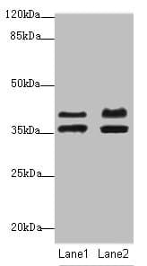 Polyclonal Rabbit anti-Human IKBIP Antibody (IHC, WB)