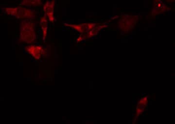 ABCC12 / MRP9 Antibody