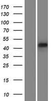 PDLIM7 / Enigma Protein (Over-Expression Lysate Myc-DDK (Flag))