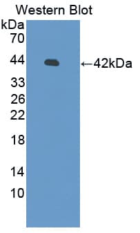 DEFB126 Antibody (aa21-111, Biotin)