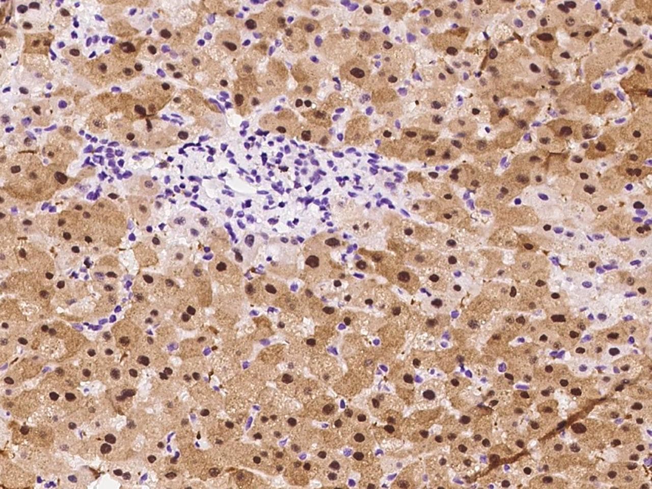 MAT / MAT1A Antibody