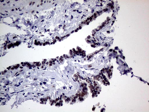 TLK2 Antibody (aa1-296, clone OTI2H2)