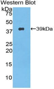 Nesfatin-1 Antibody (aa26-106)