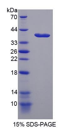 Rat NES / Nestin Protein (Recombinant His-S)