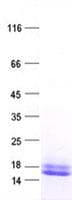 Human PPP4R4 Protein (Recombinant His, N-Terminal)