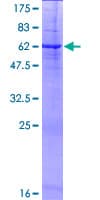 Human PRSS21 / Testisin Protein (Recombinant GST)