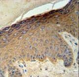 KRT35 / Keratin 35 / KRTHA5 Antibody (aa352-380)