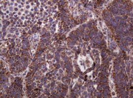 HSPD1 / HSP60 Antibody (clone OTI3G10)