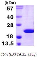 Human CIRP / CIRBP Protein (Recombinant His)