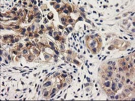 ILVBL Antibody (clone OTI1A12)