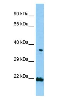 TNIP2 / ABIN-2 Antibody (aa66-115)
