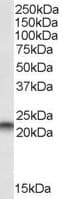 IHC-plus™ PEBP1 / RKIP Antibody (aa175-187)