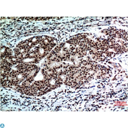 BECN1 / Beclin-1 Antibody