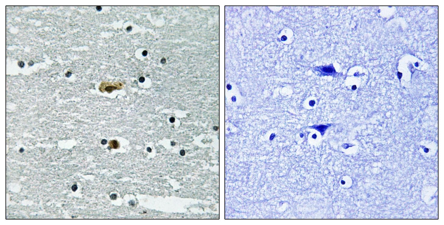 STK39 / SPAK Antibody (phospho-Ser311)