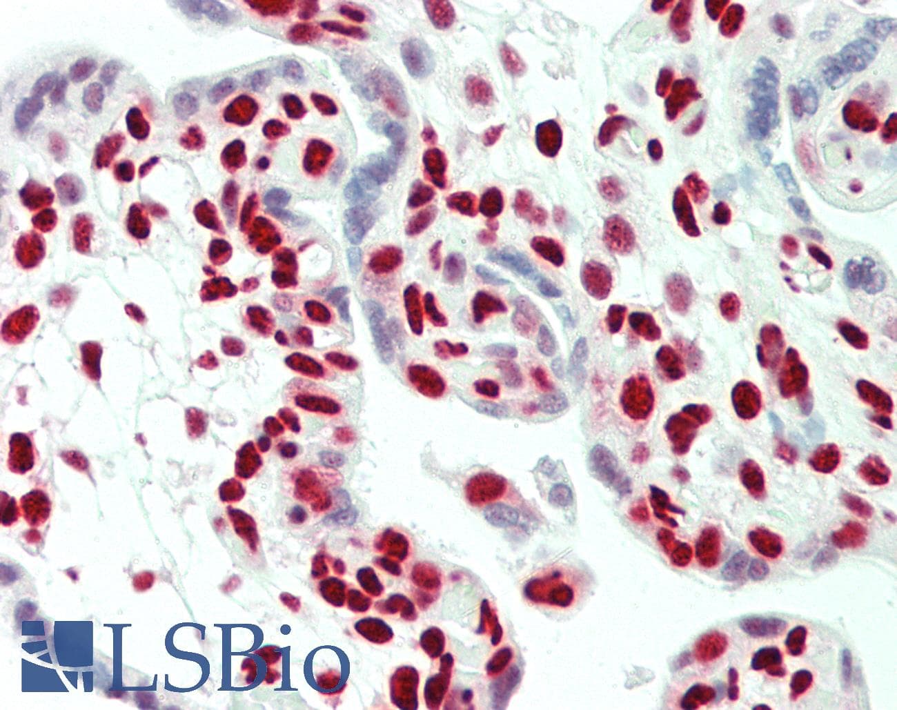 IHC-plus™ HNRNPH1 / hnRNP H Antibody (aa400-C-term)