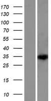 DEPDC4 Protein (Over-Expression Lysate Myc-DDK (Flag))