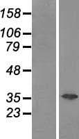 GAL4 / Galectin 4 Protein (Over-Expression Lysate Myc-DDK (Flag))