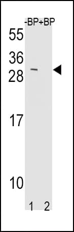 Polyclonal Rabbit anti-Human TIMP3 Antibody (aa113-139, IHC, WB)