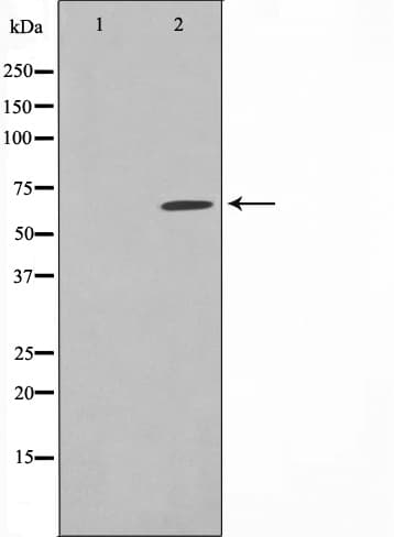 Polyclonal Rabbit anti-Human SGOL1 / Shugoshin Antibody (WB)