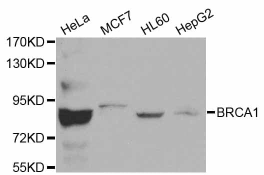 Polyclonal Rabbit anti-Human BRCA1 Antibody (IHC, IF, WB)