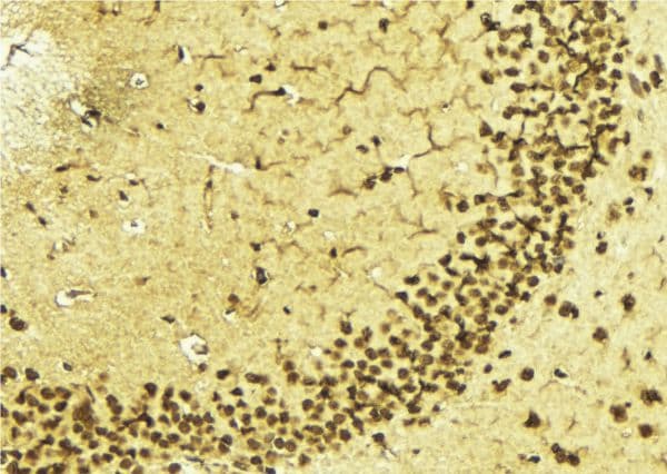 MGMT Antibody