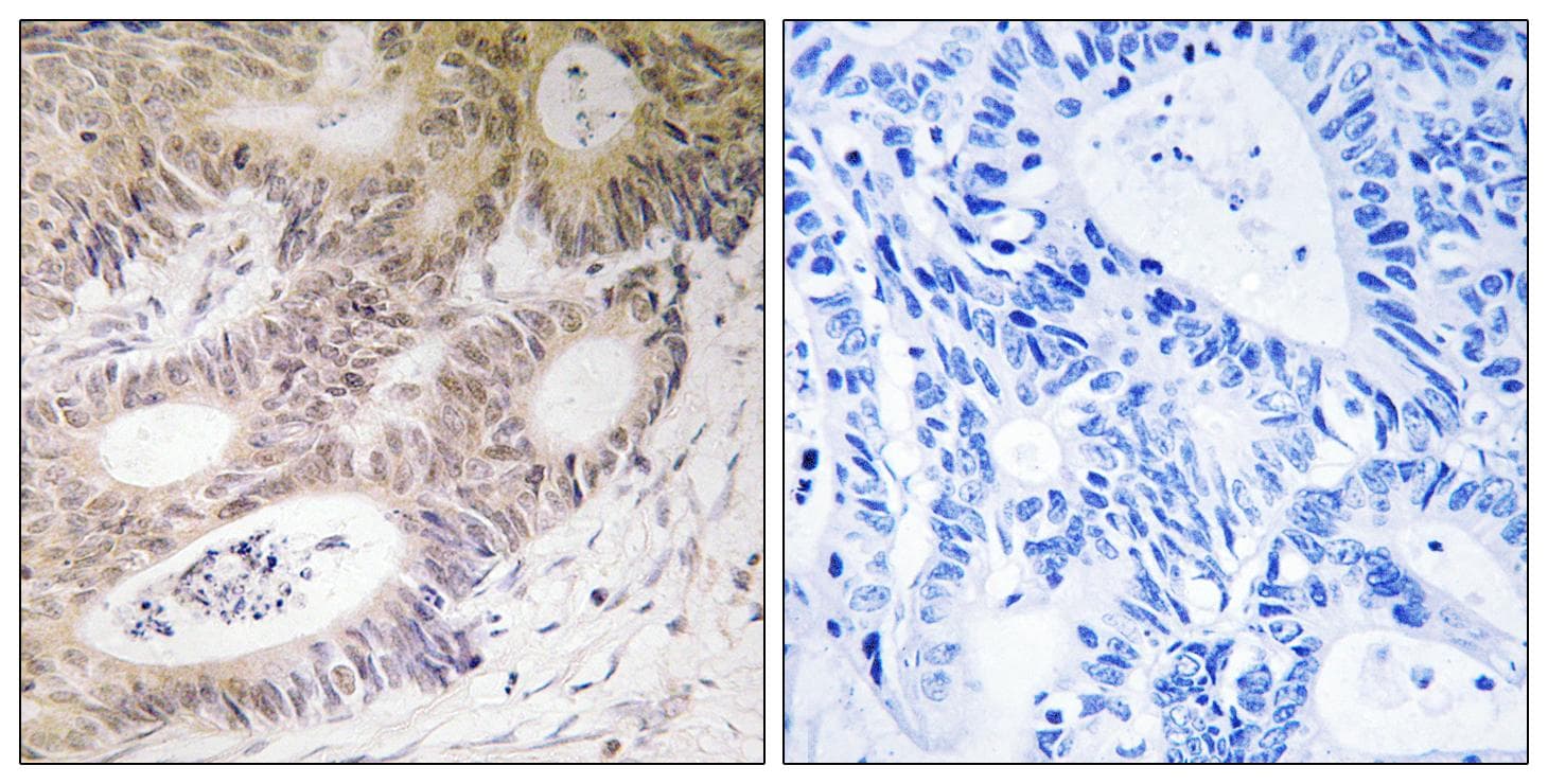 RPS6KA5 / MSK1 Antibody (Ab-212)