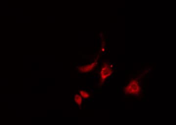 Polyclonal Rabbit anti-Human ATP5H Antibody (IF, WB)