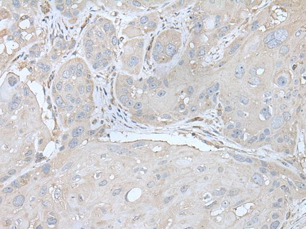 US01 / p115 Antibody