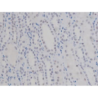 NPM1 / NPM / Nucleophosmin Antibody (phospho-Thr199)