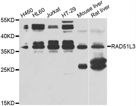 RAD51L3 / RAD51D Antibody